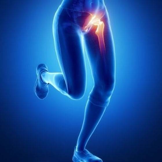 Quelles sont les causes de la pubalgie? Comment la diagnostiquer ? Quels sont les traitements possibles ? des réponses à Marseille